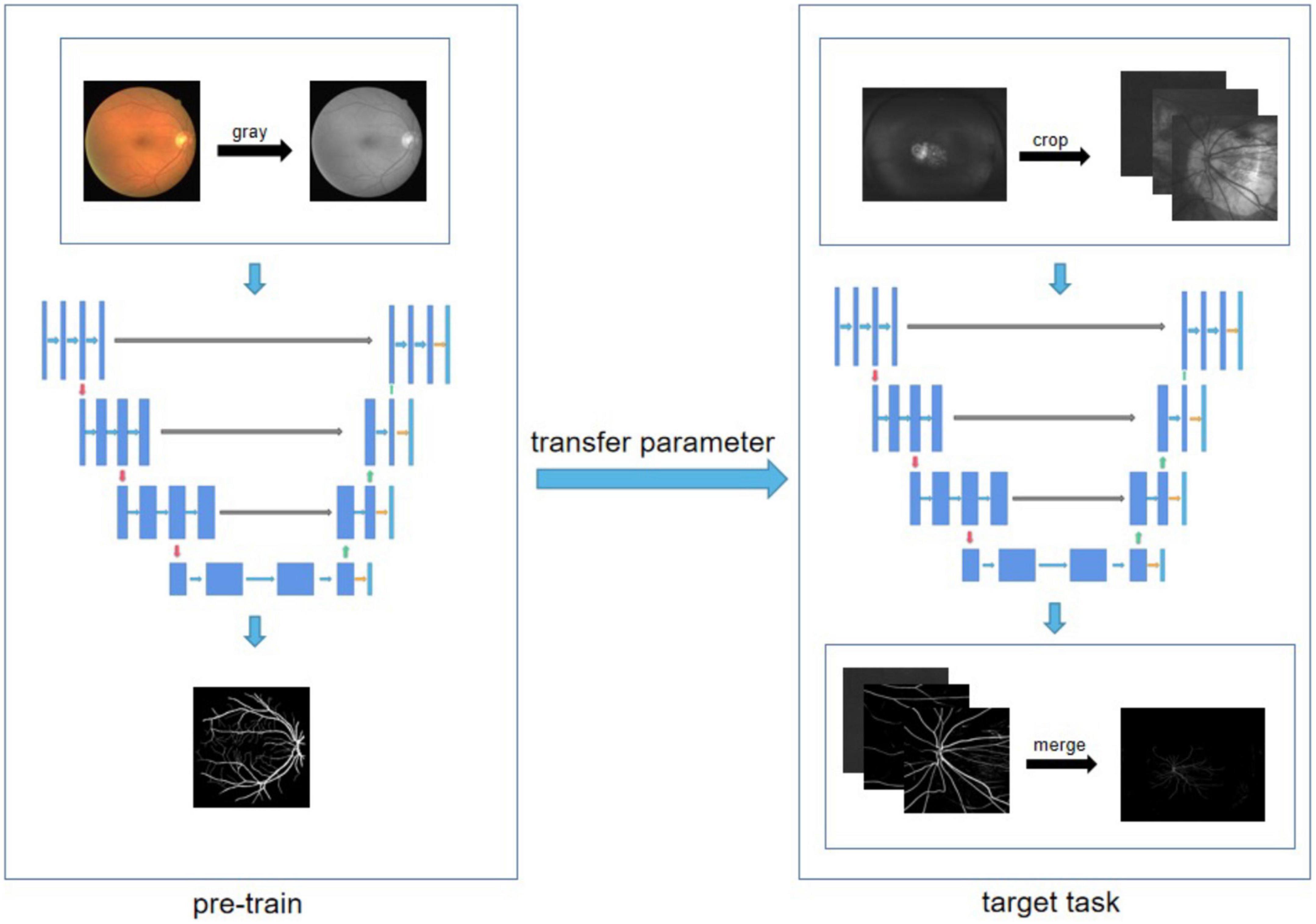 Morphological characteristics of retinal vessels in eyes with high myopia: Ultra-wide field images analyzed by artificial intelligence using a transfer learning system